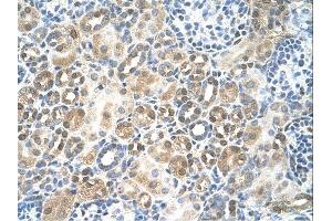RFC5 antibody was used for immunohistochemistry at a concentration of 4-8 ug/ml.