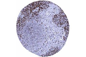 In lymph nodes ZAP70 positive lymphocytes predominate in the interfollicular zone but are much less numerous in germinal centres