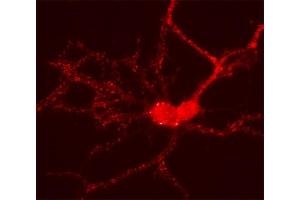 Indirect immunolabeling of PFA fixed cultured rat hippocampus neurons (dilution 1 : 500). (HOMER2 anticorps  (AA 1-176))