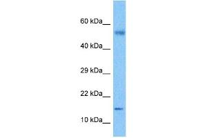 Host:  Rabbit  Target Name:  CSF2  Sample Tissue:  Lymph Node Tumor lysates  Antibody Dilution:  1ug/ml (GM-CSF anticorps  (C-Term))