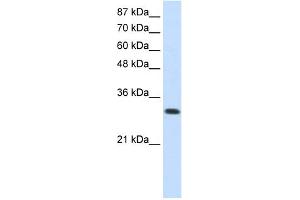 WB Suggested Anti-SCYE1 Antibody Titration:  0. (AIMP1 anticorps  (N-Term))