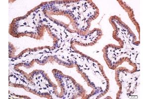 Paraformaldehyde-fixed, paraffin embedded mouse placenta, Antigen retrieval by boiling in sodium citrate buffer (pH6) for 15min, Block endogenous peroxidase by 3% hydrogen peroxide for 30 minutes, Blocking buffer (normal goat serum) at 37°C for 20min, Antibody incubation with Rabbit Anti-Prostaglandin dehydrogenase 1 Polyclonal Antibody, Unconjugated  at 1:200 overnight at 4°C, followed by a conjugated secondary for 90 minutes and DAB staining.