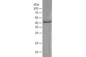 Western Blotting (WB) image for Kruppel-Like Factor 17 (KLF17) (AA 2-389) protein (His-IF2DI Tag) (ABIN7123698)