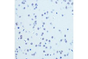 Immunohistochemistry of paraffin-embedded mouse brain using CDK9 Rabbit mAb (ABIN7266597) at dilution of 1:100 (40x lens).