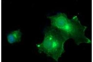 Image no. 4 for anti-Melan A (MLANA) antibody (ABIN1499423) (MLANA anticorps)