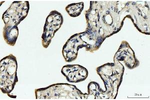 IHC analysis of CYB5B using anti-CYB5B antibody (ABIN7600312).
