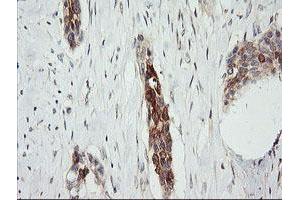 Image no. 3 for anti-Retinoic Acid Receptor Responder (Tazarotene Induced) 1 (RARRES1) antibody (ABIN1500600)