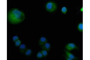 anti-Amiloride Binding Protein 1 (Amine Oxidase (Copper-Containing)) (ABP1) (AA 144-180), (N-Term) antibody