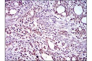 Immunohistochemistry (IHC) image for anti-Kruppel-Like Factor 1 (erythroid) (KLF1) (AA 208-362) antibody (ABIN1845960)