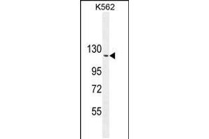 Western blot analysis in K562 cell line lysates (35ug/lane). (ARHGAP17 anticorps  (N-Term))