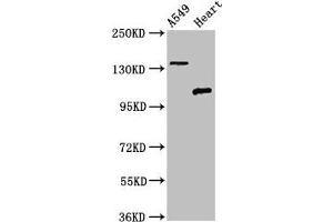 Western Blot Positive WB detected in: A549 whole cell lysate, Rat heart tissue All lanes: ADGRA2 antibody at 3 μg/mL Secondary Goat polyclonal to rabbit IgG at 1/50000 dilution Predicted band size: 143, 120, 20 kDa Observed band size: 143, 120 kDa (GPR124 anticorps  (AA 1069-1338))