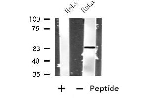 Western blot analysis of extracts from HeLa cells, using IL4I1 antibody. (IL4I1 anticorps  (N-Term))