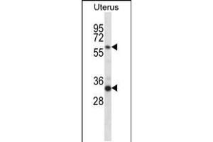 Western blot analysis in human normal Uterus tissue lysates (35ug/lane). (Fam172a anticorps  (AA 203-232))