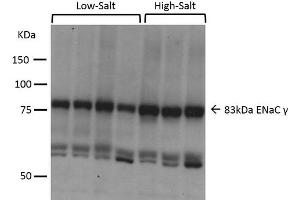 Western blot analysis of Mouse kidney cortex showing detection of ENaC protein using Rabbit Anti-ENaC Polyclonal Antibody . (SCNN1A anticorps  (AA 629-650) (PerCP))