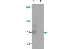 Western blot analysis of rat brain tissue with ZC3H12C polyclonal antibody  at 1 ug/mL in (Lane 1) the absence and (Lane 2) the presence of blocking peptide. (ZC3H12C anticorps  (N-Term))