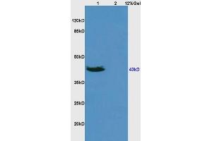 L1 human colon carcinoma lysates L2 rat brain lysates probed with Anti DR3/APO3/TWEAK Polyclonal Antibody, Unconjugated (ABIN668421) at 1:200 overnight at 4 °C.
