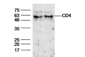 probed with Anti-CD4 Polyclonal Antibody, Unconjugated  at 1:5000 for 90 min at 37˚C.