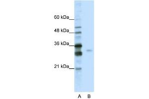 WB Suggested Anti-SFRS1 Antibody Titration:  0. (SRSF1 anticorps  (C-Term))