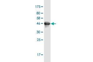 Western Blot detection against Immunogen (45. (UBALD1 anticorps  (AA 1-177))