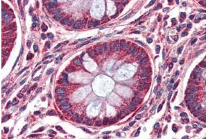 Anti-MMP14 antibody IHC of human colon. (MMP14 anticorps  (AA 160-173))