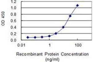 Detection limit for recombinant GST tagged IRAK2 is 0.
