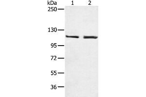 Western Blotting (WB) image for anti-Telomerase Reverse Transcriptase (TERT) antibody (ABIN2426079) (TERT anticorps)