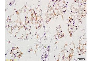 Formalin-fixed and paraffin embedded mouse stomach labeled with Anti-EGFRvIII Polyclonal Antibody, unconjugated  (ABIN742035) at 1: 200 followed by incubation with conjugated secondary antibody and DAB staining (EGFRviii anticorps  (AA 1-50))