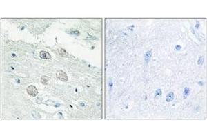 Immunohistochemistry analysis of paraffin-embedded human brain tissue, using JAK1 Antibody. (JAK1 anticorps  (AA 91-140))