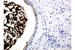 Image no. 3 for anti-WAP Four-Disulfide Core Domain 2 (WFDC2) (AA 31-124) antibody (ABIN1491389)