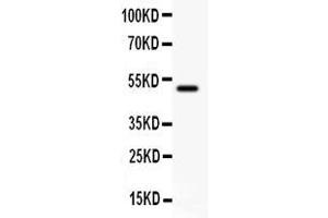 Anti- CD80 antibody, Western blottingAll lanes: Anti CD80  at 0. (CD80 anticorps  (C-Term))