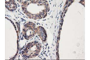 Immunohistochemical staining of paraffin-embedded Human breast tissue using anti-HARS2 mouse monoclonal antibody. (HARS2 anticorps)