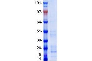 Validation with Western Blot