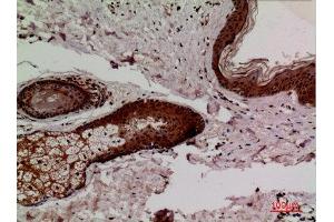 Immunohistochemistry (IHC) analysis of paraffin-embedded Human Skin, antibody was diluted at 1:100.