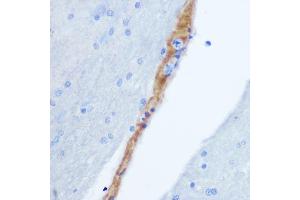 Immunohistochemistry of paraffin-embedded rat brain using GRP Rabbit pAb (ABIN6127573, ABIN6141433, ABIN6141434 and ABIN6222002) at dilution of 1:100 (40x lens).