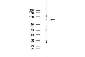 anti-Repetin (RPTN) (C-Term) antibody