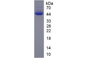 SDS-PAGE analysis of Human PFKM Protein. (PFKM Protéine)