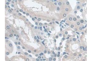 DAB staining on IHC-P; Samples: Rat Kidney Tissue (Butyrylcholinesterase anticorps  (AA 345-570))