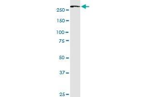 FASN monoclonal antibody (M02), clone 3B3-1D6. (Fatty Acid Synthase anticorps  (AA 1-439))
