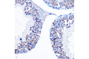 Immunohistochemistry of paraffin-embedded mouse testis using DDX4 Rabbit pAb (ABIN7266705) at dilution of 1:100 (40x lens). (DDX4 anticorps  (AA 1-300))