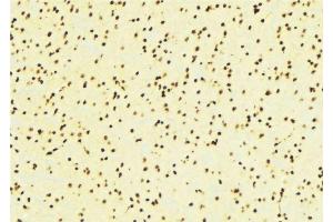ABIN6276424 at 1/100 staining Mouse brain tissue by IHC-P. (ARNT anticorps  (N-Term))