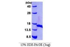 Figure annotation denotes ug of protein loaded and % gel used. (DsbE (AA 26-185) Peptide)