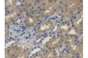 IHC-P analysis of Rat Kidney Tissue, with DAB staining. (Sonic Hedgehog anticorps  (AA 237-399))