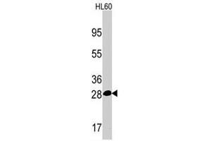 Western blot analysis of PSMA5 polyclonal antibody  in HL-60 cell line lysates (35 ug/lane). (PSMA5 anticorps  (Internal Region))