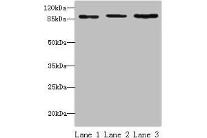 Western blot All lanes: STAT5B antibody at 16 μg/mL Lane 1: HepG2 whole cell lysate Lane 2: K562 whole cell lysate Lane 3: Hela whole cell lysate Secondary Goat polyclonal to rabbit IgG at 1/10000 dilution Predicted band size: 90 kDa Observed band size: 90 kDa