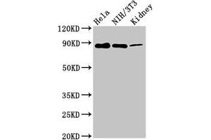 Western Blot Positive WB detected in: Hela whole cell lysate, NIH/3T3 whole cell lysate, Rat kidney tissue All lanes: PTPN12 antibody at 7. (PTPN12 anticorps  (AA 539-714))