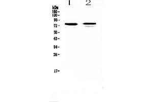 Western blot analysis of FZD3 using anti-FZD3 antibody .