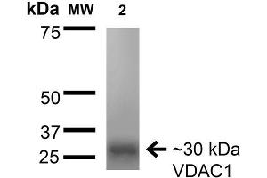 Western Blot analysis of Rat Brain Membrane showing detection of ~30 kDa VDAC1 protein using Mouse Anti-VDAC1 Monoclonal Antibody, Clone S152B-23 . (VDAC1 anticorps  (AA 1-283) (PerCP))