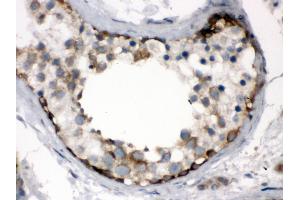 Immunohistochemistry (Paraffin-embedded Sections) (IHC (p)) image for anti-T-Complex 1 (TCP1) (AA 515-551), (C-Term) antibody (ABIN3043417) (TCP1 alpha/CCTA anticorps  (C-Term))