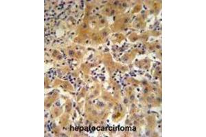 Immunohistochemistry (IHC) image for anti-Ceruloplasmin (Ferroxidase) (CP) antibody (ABIN3003152)