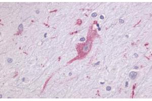 Anti-LPHN1 antibody  ABIN1049022 IHC staining of human brain, neurons and glia. (Latrophilin 1 anticorps  (N-Term))